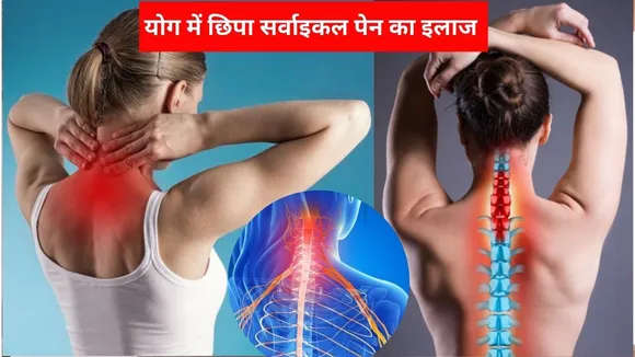 Yoga For Cervical Pain
