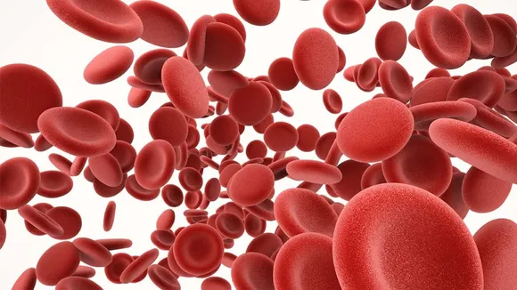 Hemoglobin Deficiency