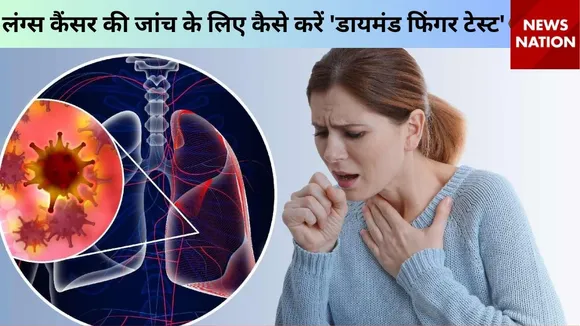 lung cancer