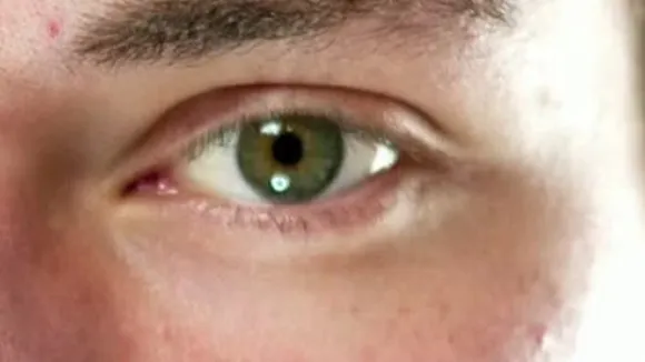 eye 