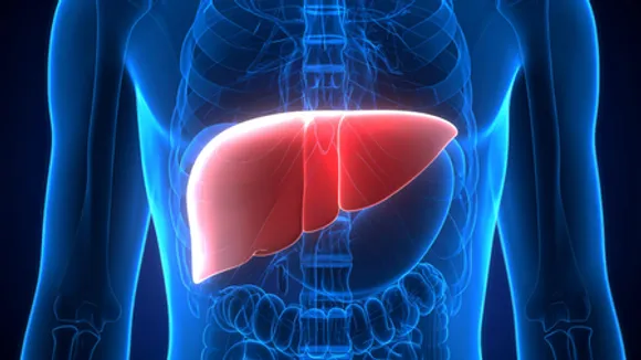 New blood test to predict risk of liver cirrhosis, cancer within 10 years