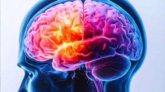 Calcium supplements may not lead to dementia in older women: The Lancet