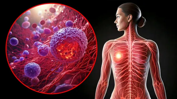 Study warns high-fat keto diet may drive breast cancer
