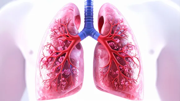 Chest X-rays inadequate to detect asymptomatic TB among household contacts: The Lancet