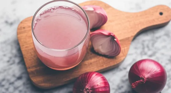 बालों को पोषण देगा प्याज का रस, झड़ने समेत अनेक समस्याओं से मिलेगी राहत