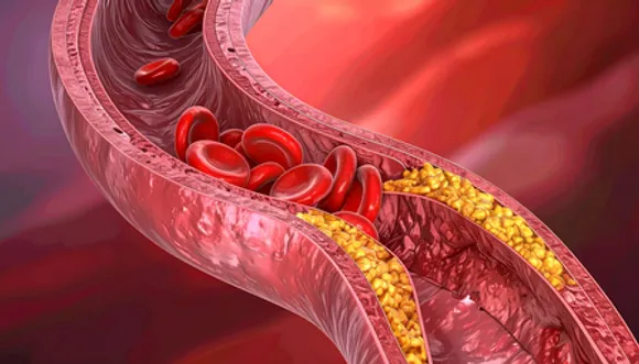 कोलेस्ट्रॉल: खतरनाक नहीं, सिर्फ संतुलन की जरूरत