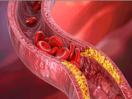 आयरन: शरीर की ऊर्जा का मुख्य स्त्रोत है आयरन, कमी शरीर को कर देगी अधमरा