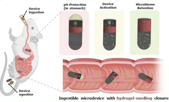 IIT Delhi, AIIMS’s new ingestible device can collect microbial samples from small intestine