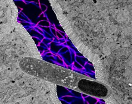 US researchers find gut bacteria that can help lose weight, boost metabolic health