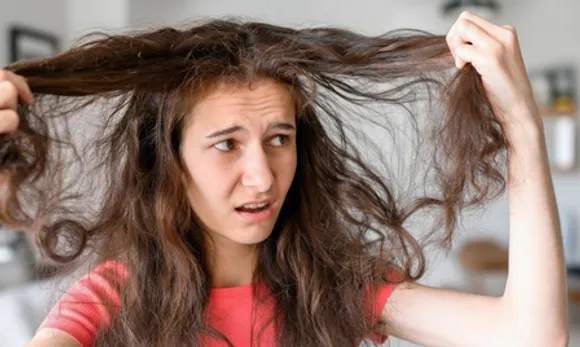 rukhe-aur-frizzy-baalo-se-pareshan-yeh-natural-hair-pack-dega-mulayam-aur-majboot-baal