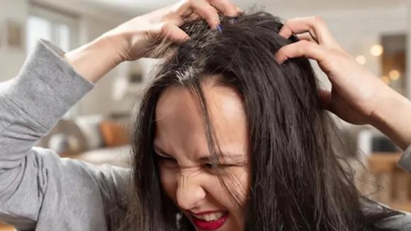 सिर से जूं और लीखों को तुरंत खत्म करेंगे ये उपाय, खुजली और डैंड्रफ से भी मिलेगी राहत