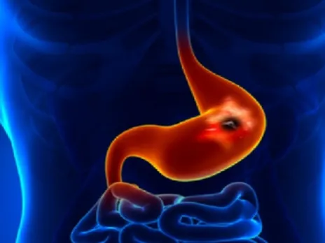 “लाइफ कंट्रोल सेंटर” है पैंक्रियास, अनदेखा करना होगा सेहत के साथ खिलवाड़