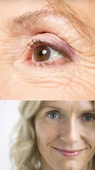 Beauty: Wrinkles से निजात पाने के लिए करें ये खास उपाय