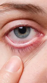 गर्मी में इस तरह रखें अपनी आंखों का ख्याल!