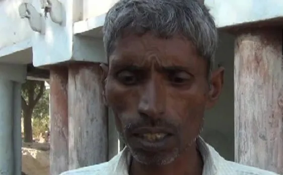 2000 रुपयों के लिए अलीगढ़ के एक शख्स ने कराई नसबंदी, खाने तक को नहीं थे पैसे
