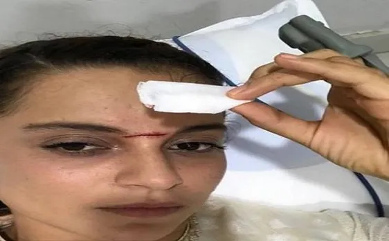 मणिकर्णिका की शूटिंग के दौरान कंगना को लगी तलवार, अस्पताल में भर्ती