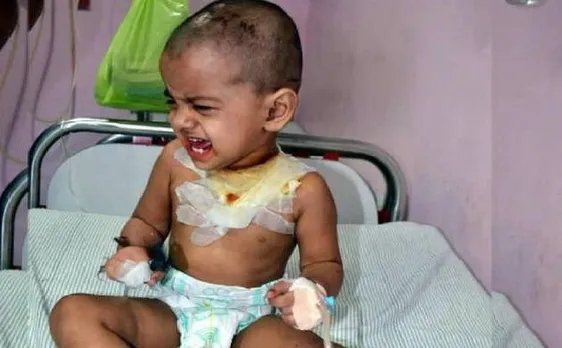 मुजफ्फरनगर ट्रेन हादसे में माता-पिता से बिछड़ गई 3 साल की बच्ची, अस्पताल में भर्ती