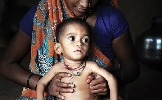 नीति आयोग ने जारी किया राष्ट्रीय पोषण रणनीति, कुपोषण से लड़ने में मिलेगी मदद