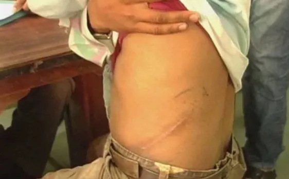 उत्तराखंड: हॉस्पिटल में चल रहे किडनी रैकेट का पुलिस ने किया पर्दाफाश