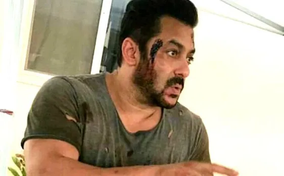 'टाइगर जिंदा है' के सेट पर चोटिल नजर आए सलमान खान, वायरल हुई PHOTO