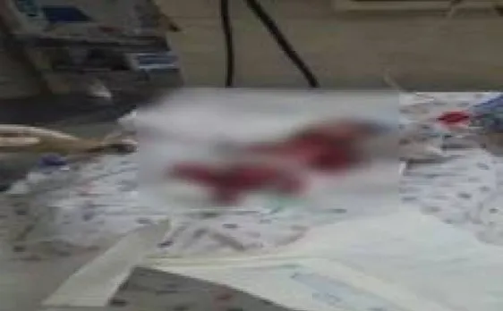 मध्य प्रदेशः स्टाफ नर्स की लापरवाही की वजह से नवजात शिशु की मौत, जांच जारी