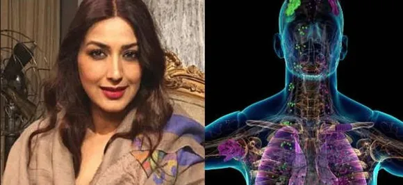 मेटास्टेटिक कैंसर से जूझ रही है सोनाली बेंद्रे, जानिए कारण और बचाव