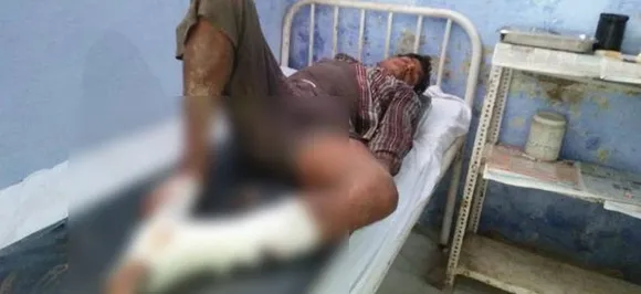 जम्मू-कश्मीर: अरनिया में बम विस्फोट, एक मजदूर की मौत, छह घायल
