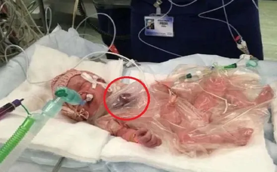 अल्ट्रासाउंड के लिए अस्पताल गई थी प्रेगनेंट महिला, स्क्रीन पर दिखाई दी ऐसी चीज.. सन्न रह गए डॉक्टर