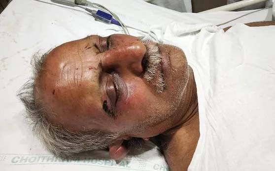 मध्य प्रदेश में कांग्रेस के जिला उपाध्यक्ष का अपहरण, बदमाशों ने काट लीं मूंछें