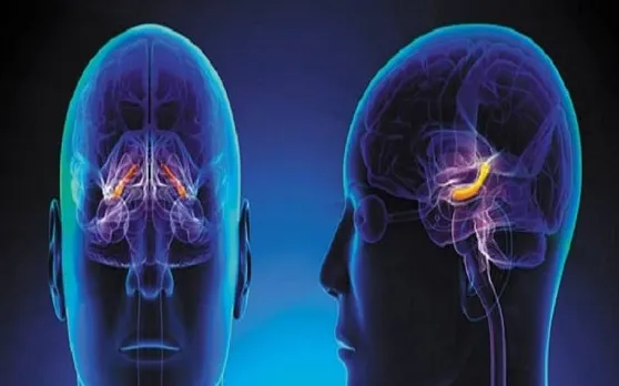 सावधान! तेजी से बढ़ रहा है Brain tumor, जानें इसके लक्षण और इलाज