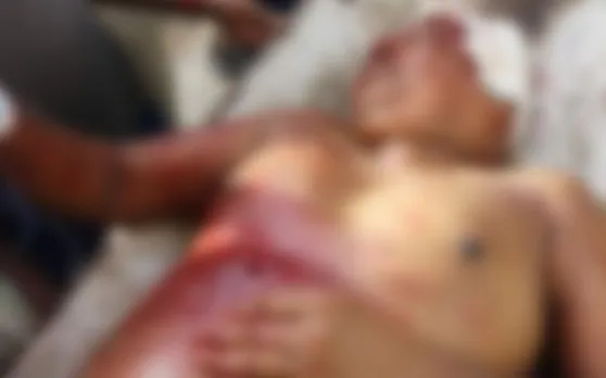 बिहार : बेलगाम बदमाशों ने भरे बाजार डॉक्टर पर दागीं कई गोलियां, हालत गंभीर