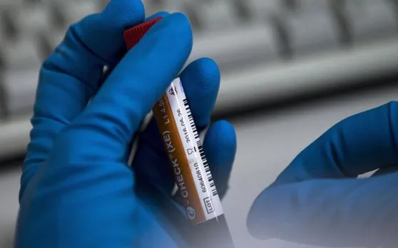 WADA की बड़ी कार्रवाई, भारत की राष्ट्रीय डोप जांच प्रयोगशाला निलंबित