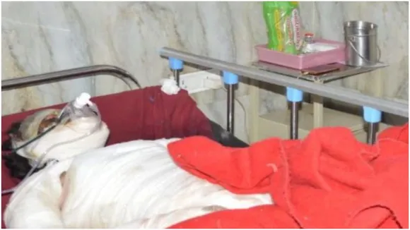 दबंगों ने किशोरी को पेट्रोल डाल किया आग के हवाले, इलाज के दौरान हुई मौत