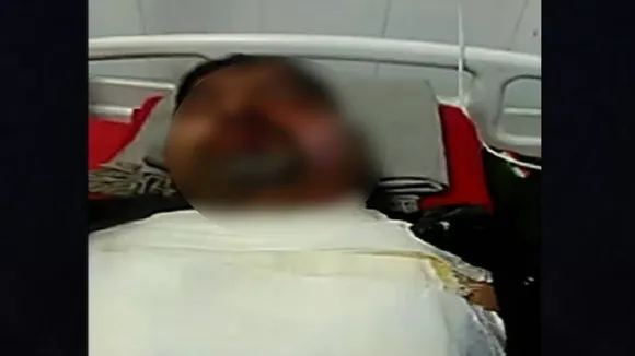 गुस्से में CRPF के डीआईजी ने सिपाही पर फेंका खौलता पानी, उतर गई चेहरे की चमड़ी