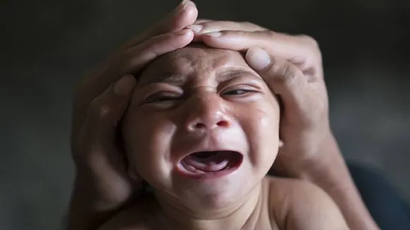 खराब आहार से जुड़ा है जन्मजात जीका सिंड्रोम, शोध में हुआ खुलासा
