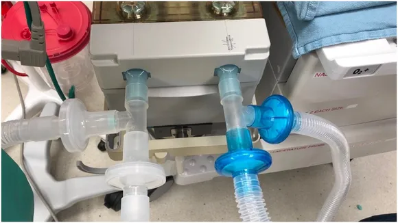 Ventilator
