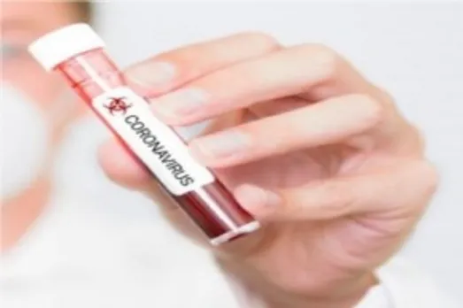 coronavirus1