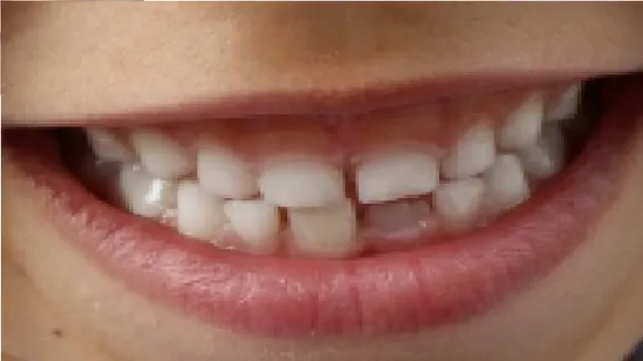 Teeth