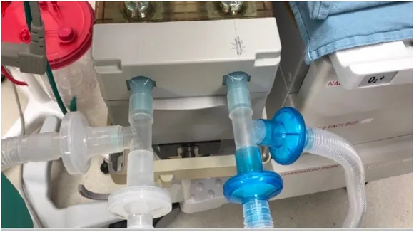 Ventilator