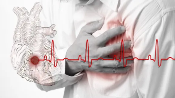 Heart Attack