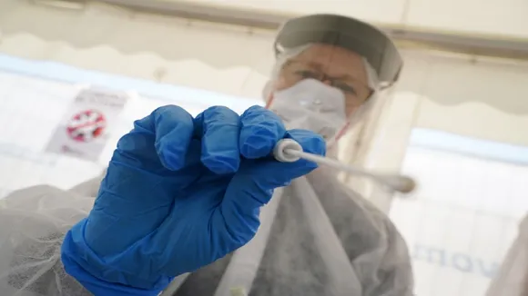 anal swab test