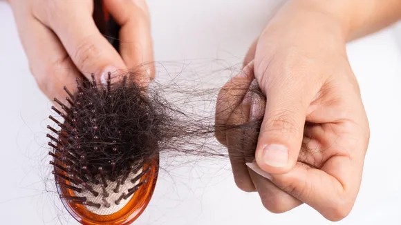 hair fall comtrol