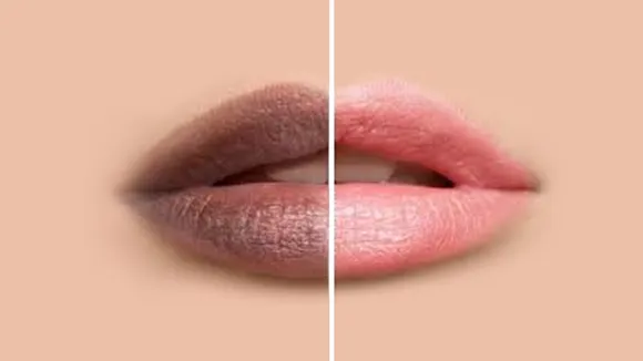 lips home remedies