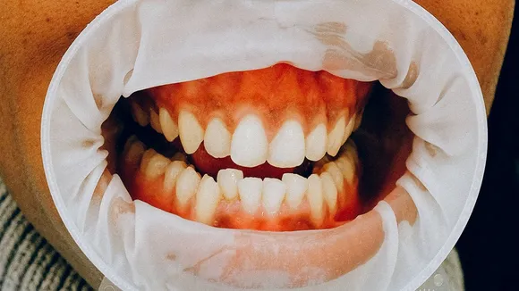 oral health day