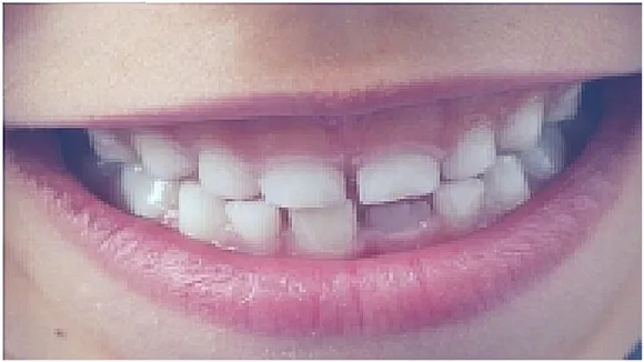 Oral Health Day-Easy Tips To keep Your Teeth Healthy