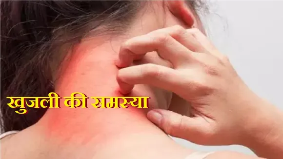 Itching Problem