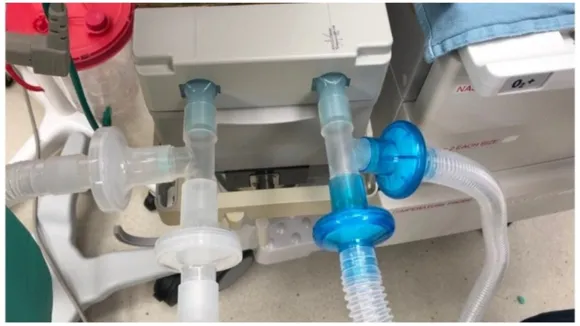 वेंटिलेटर (Ventilator)