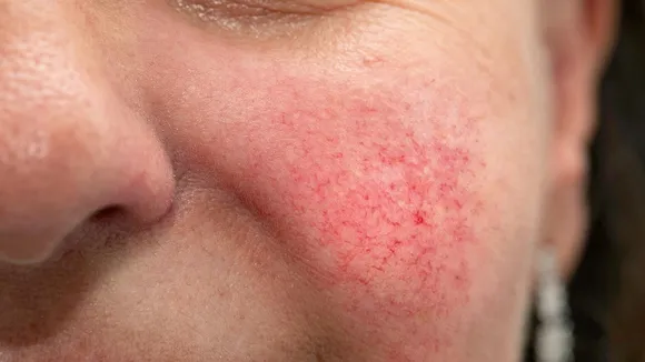 skin care tips causes problems and home remedies