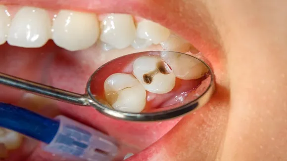 home remedies for mouth cavity