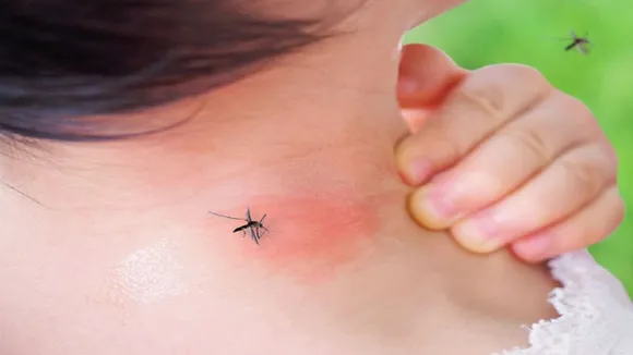 mosquito b4576565765